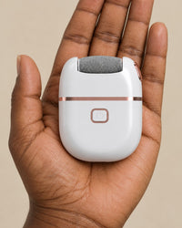 The callus remover held in one hand, showing its palm-sized body